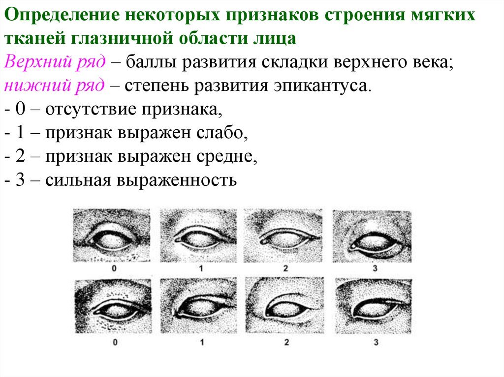 Некоторые признаки. Строение верхнего века и эпикантуса. Степень развития складки верхнего века. Эпикантус степени выраженности. Складка верхнего века развита слабо.