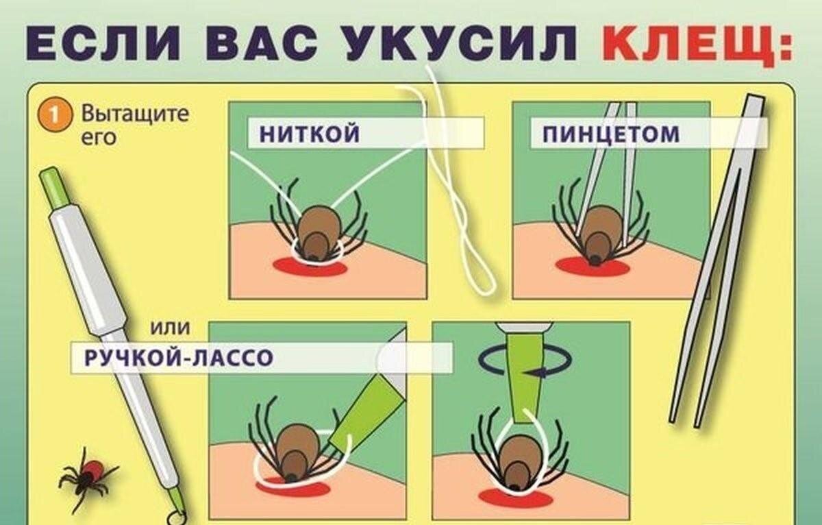 Как правильно достать клеща