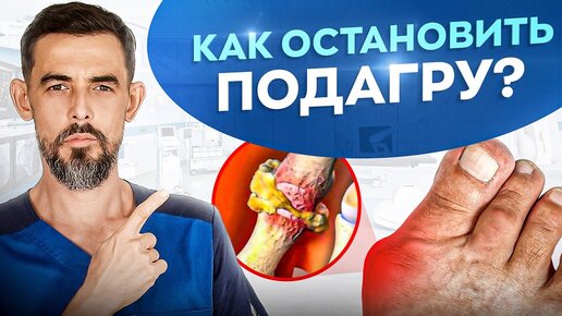 Подагра. Что делать? Моментально растворяет Кристаллы Мочевой Кислоты