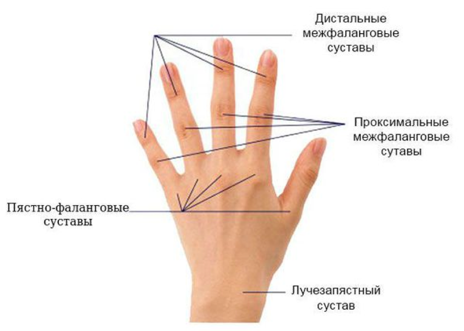 Артрит межфаланговых. Проксимальные межфаланговые суставы. Запястье руки где находится фото у человека.