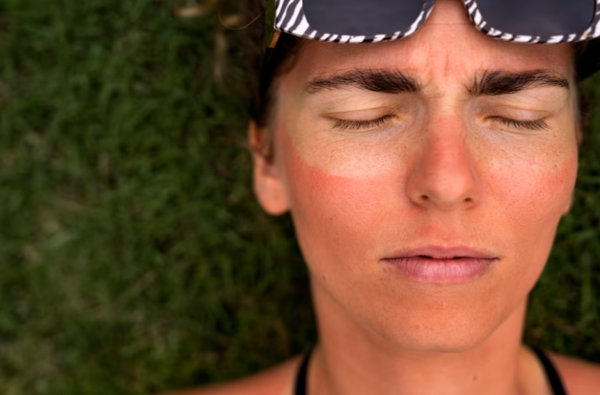 https://ru.freepik.com/free-photo/portrait-of-adult-woman-with-sunburn-skin_40165494.htm#query=заслоняется%20от%20солнышка&position=12&from_view=search&track=ais