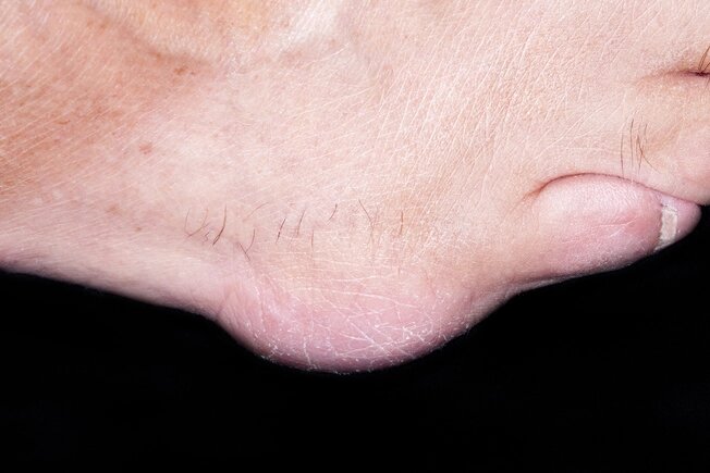 Sănătatea picioarelor este foarte importantă pentru menținerea mobilității la orice vârstă, așa că acest material va fi de interes pentru oricine îi pasă de picioarele lor.-13