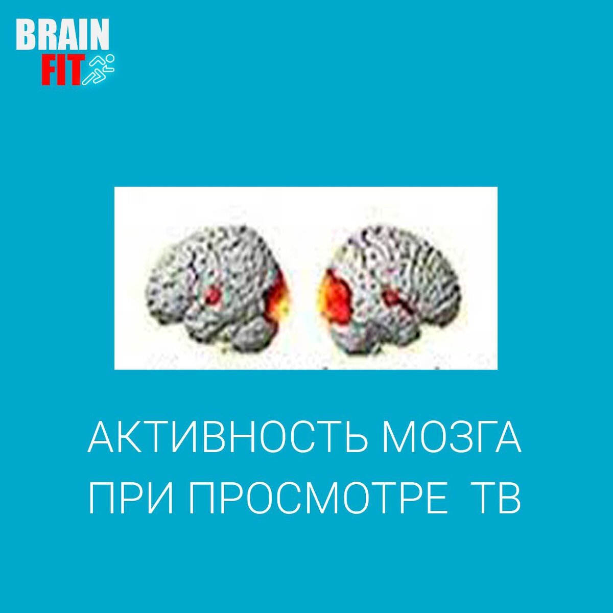 Источник фото: brain-fit