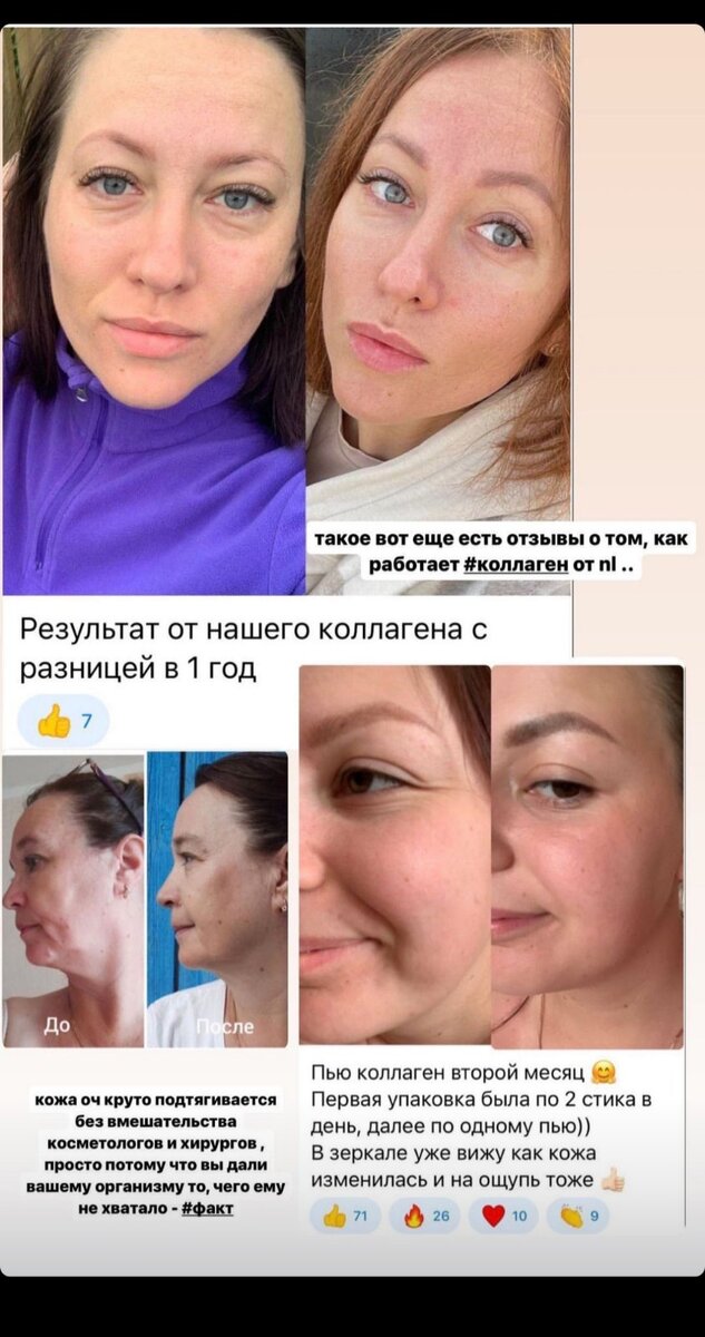 Коллагенарий отзывы фото до и после Коллаген что это? Анна Купырова Дзен