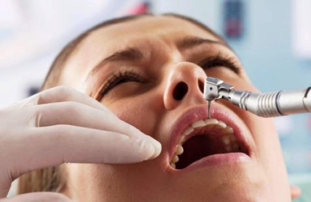 Стоматолог сверлит зуб