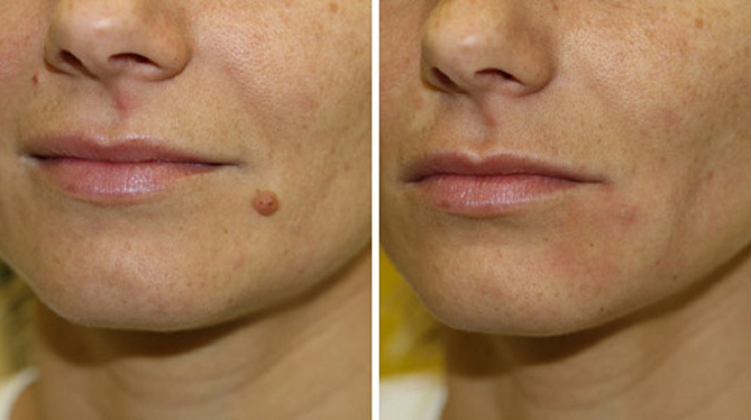 Все используемые методы обеспечивают безупречный результат!