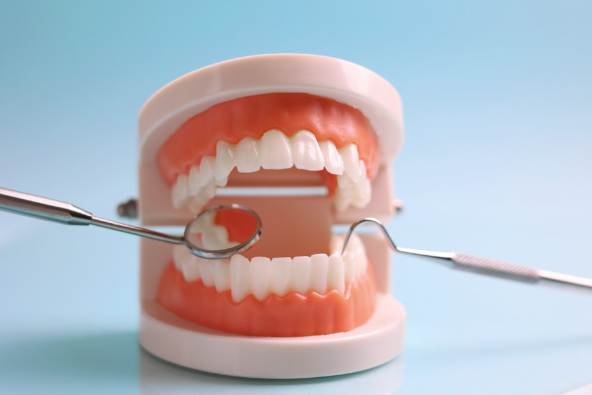 Стоматология мудрый. Ретинированных и дистопированных зубов. Ретинированных – дистопированных зубов 1 степени.
