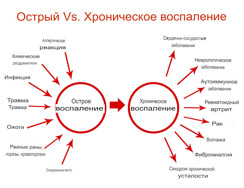 Два воспаления https://woburnosteopaths.co.uk/2022/11/inflammation-explained/
