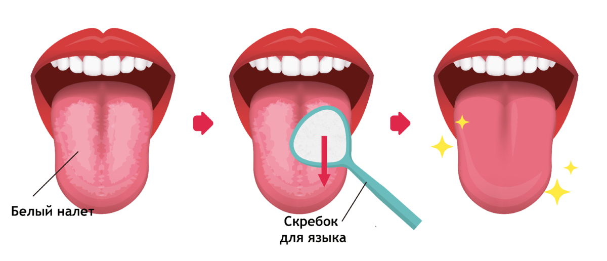 Как легче очистить язык. Как ухаживать за языком. Гигиена органа чувств языка.