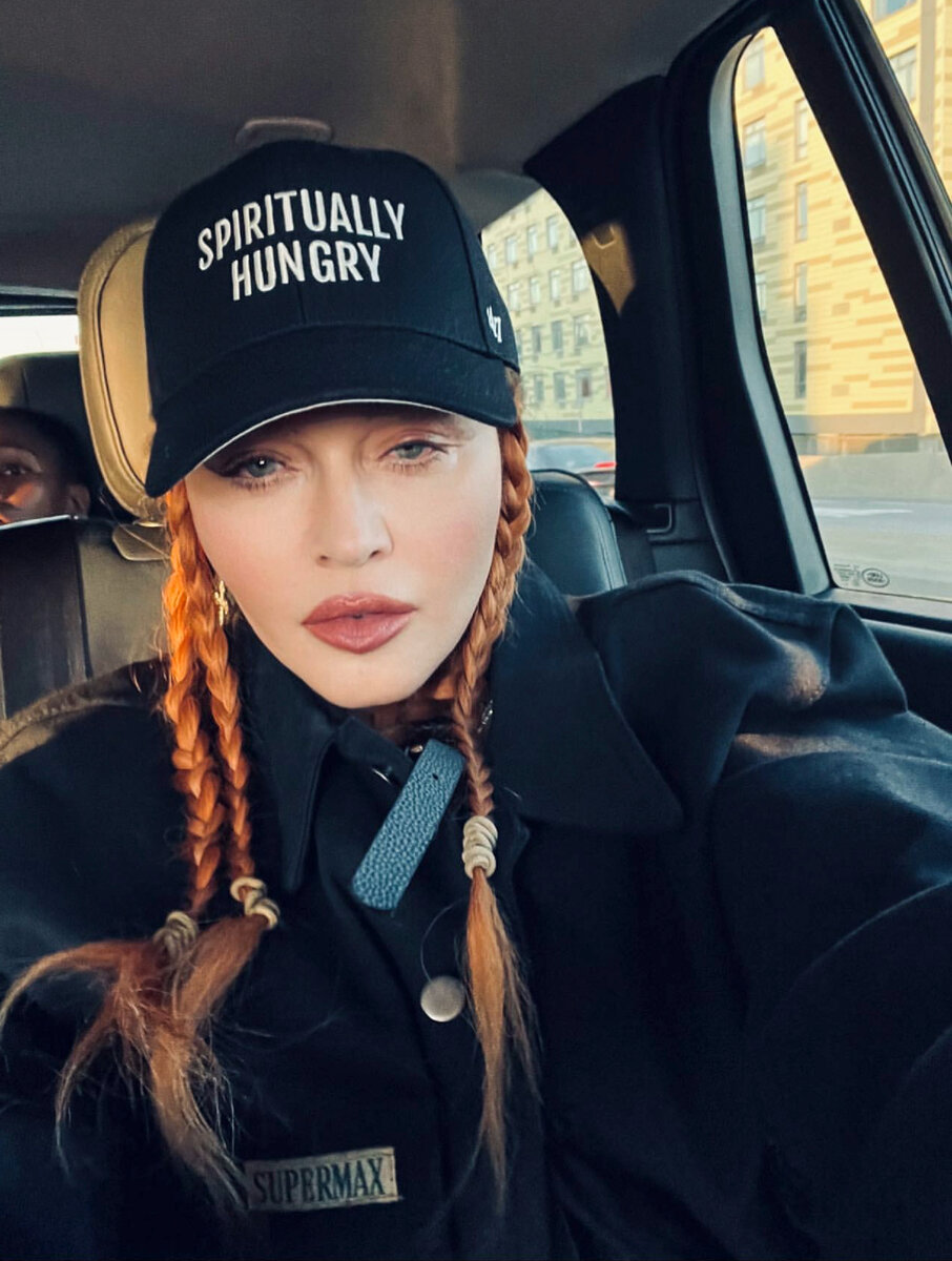 «Увлеклась пластикой»: почему Мадонна попала в реанимацию — мнение терапевта 