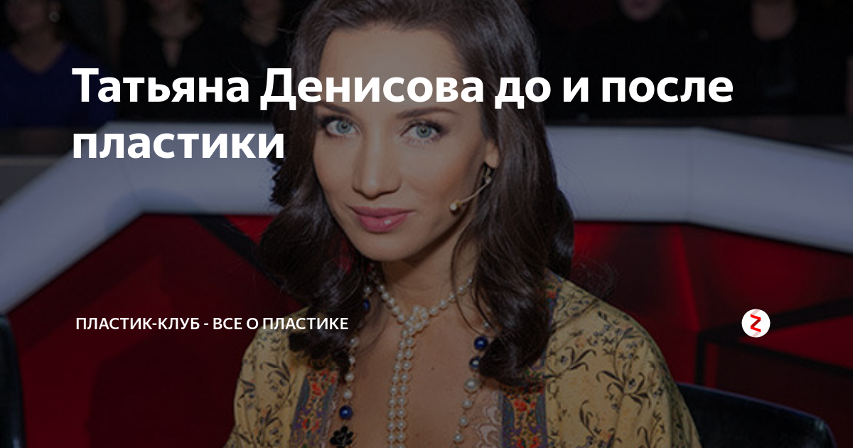 Татьяна Денисова до и после пластики лица (Фото) Умница-Красавица