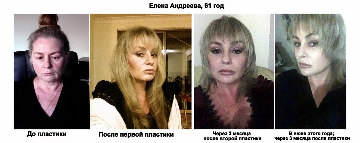 Марина соколова актриса фото до пластики и после