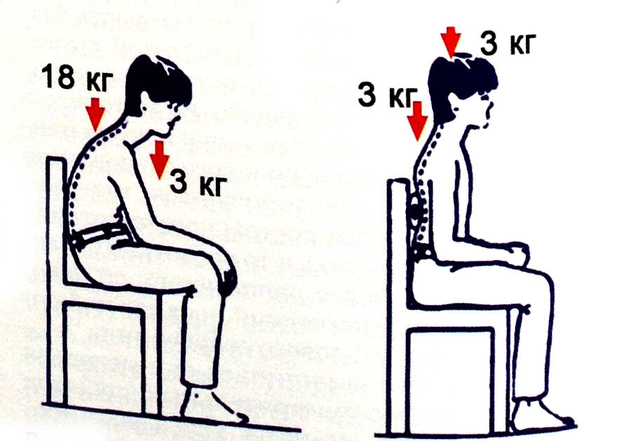 Источник: http://orthodont.by/index.php/ortodontiya/%D0%BE%D1%81%D0%B0%D0%BD%D0%BA%D0%B0-%D0%B8-%D0%BF%D1%80%D0%B8%D0%BA%D1%83%D1%81