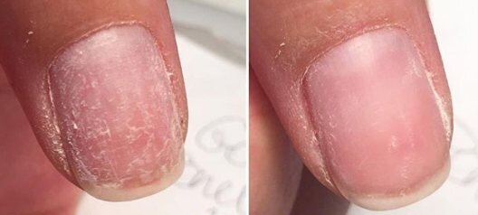 Ваши ногти не восстановятся после того, как вы содрали гель-лак. Развеиваю мифы по восстановлению ногтей