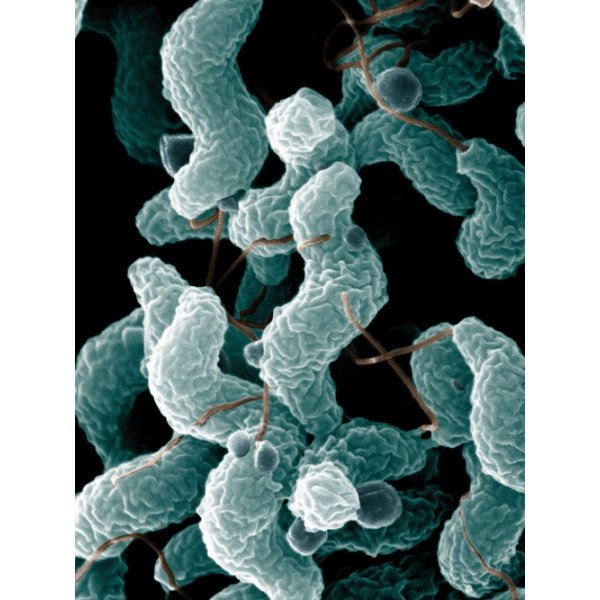           Бактерия Salinibacter ruber