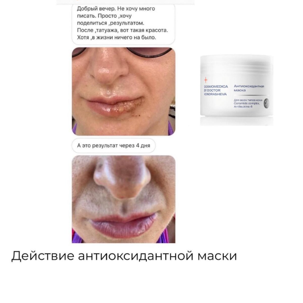 -2-2