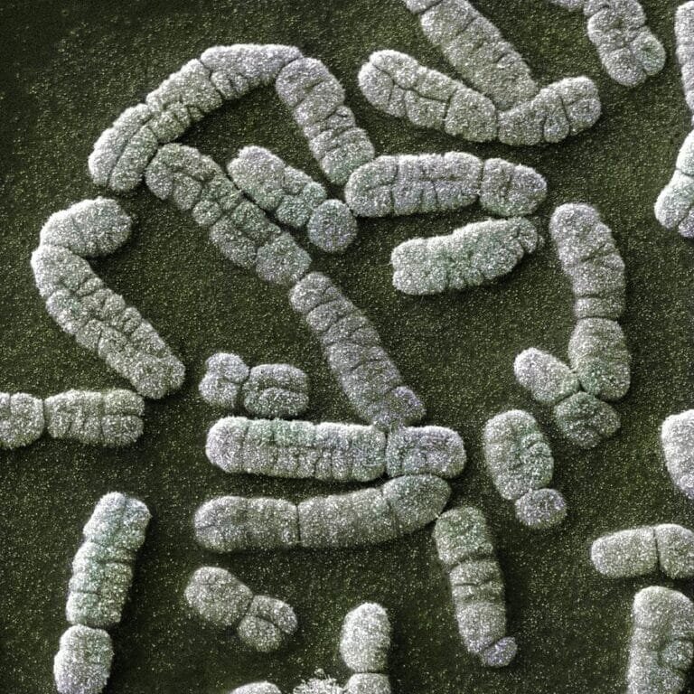    Человеческие хромосомы под сканирующим электронным микроскопом / © sciencephotogallery