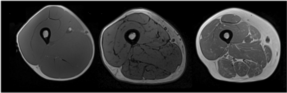 25 лет/ 35 лет/ 45 лет