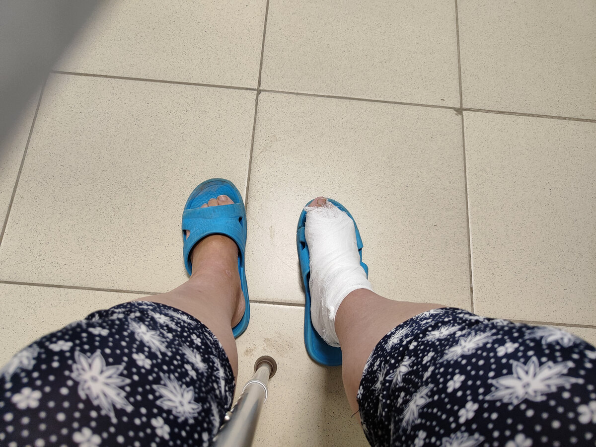 только эти шлепки налезли...