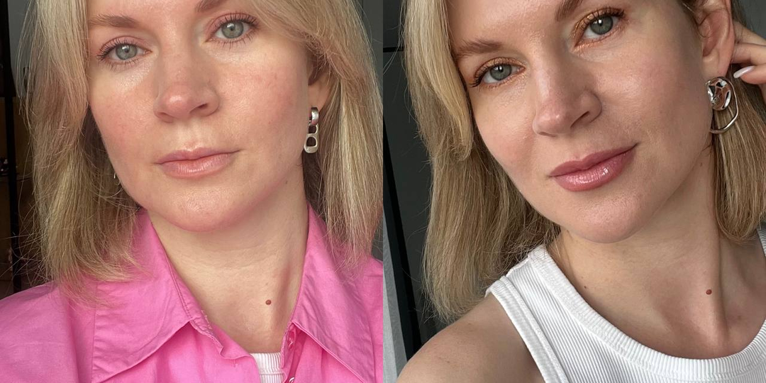 Месяц без сахара, молочки и вредных продуктов: как изменилось мое лицо и тело. Я в шоке от результатов