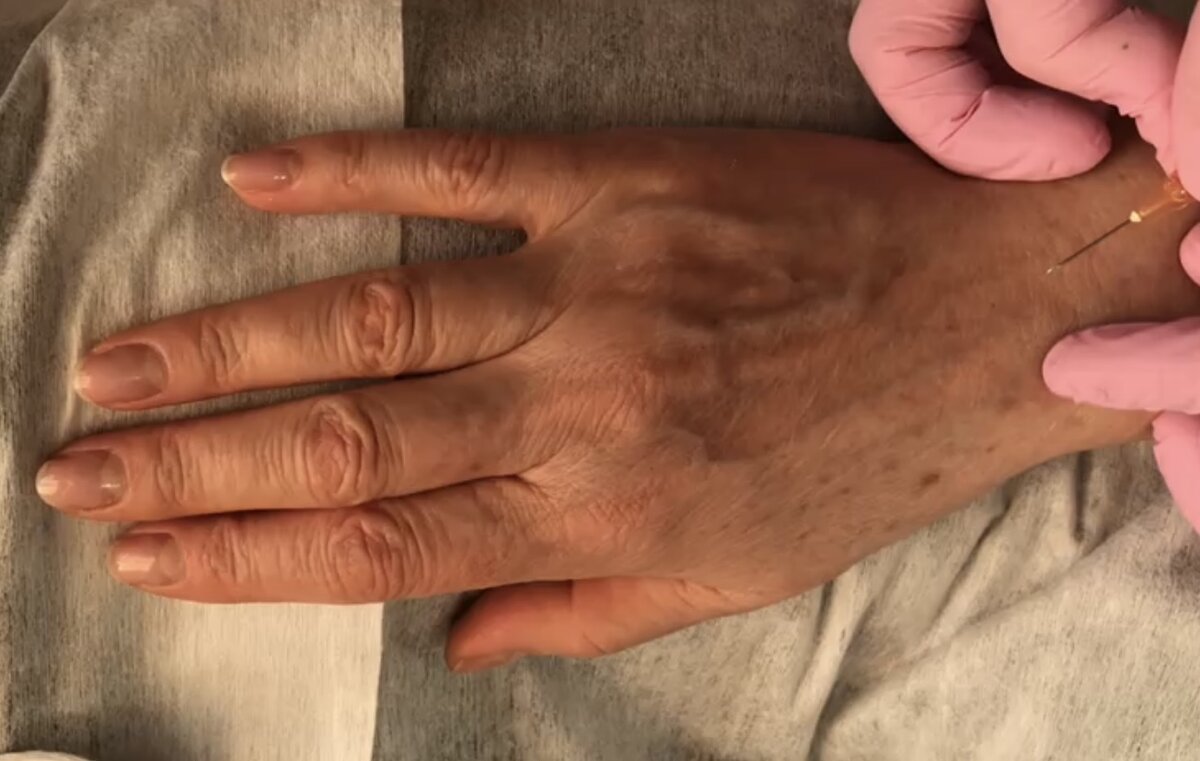 -2