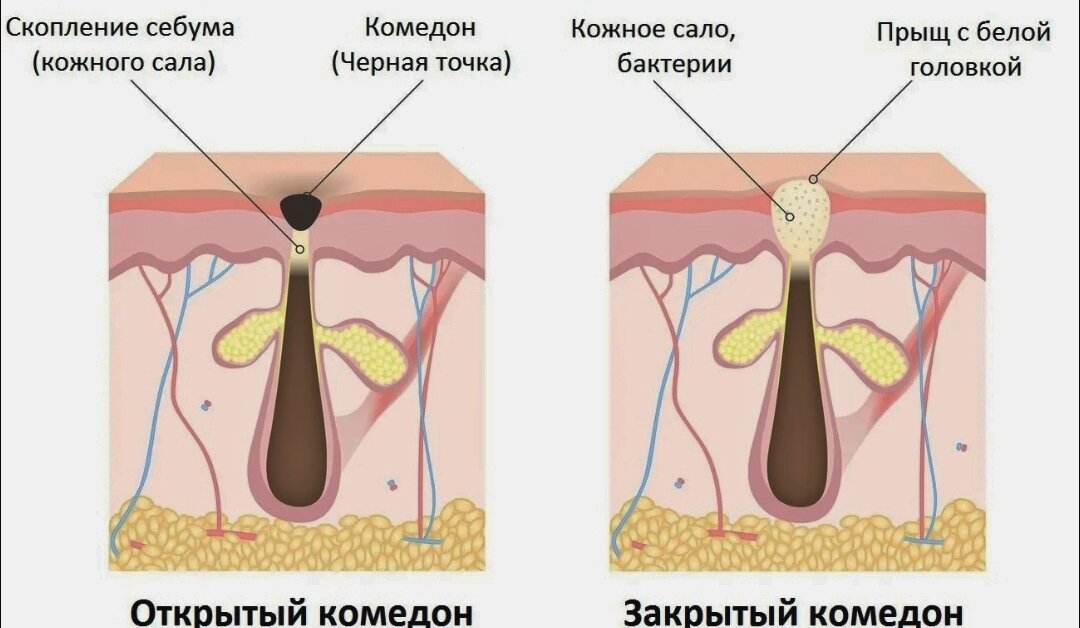 Избавиться от черных точек