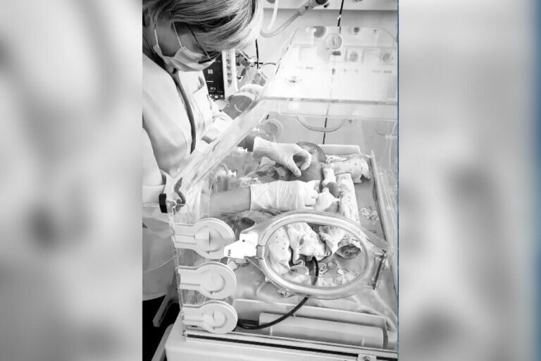    Оренбургские врачи спасли жизнь недоношенному новорожденному малышу Марина Шарт