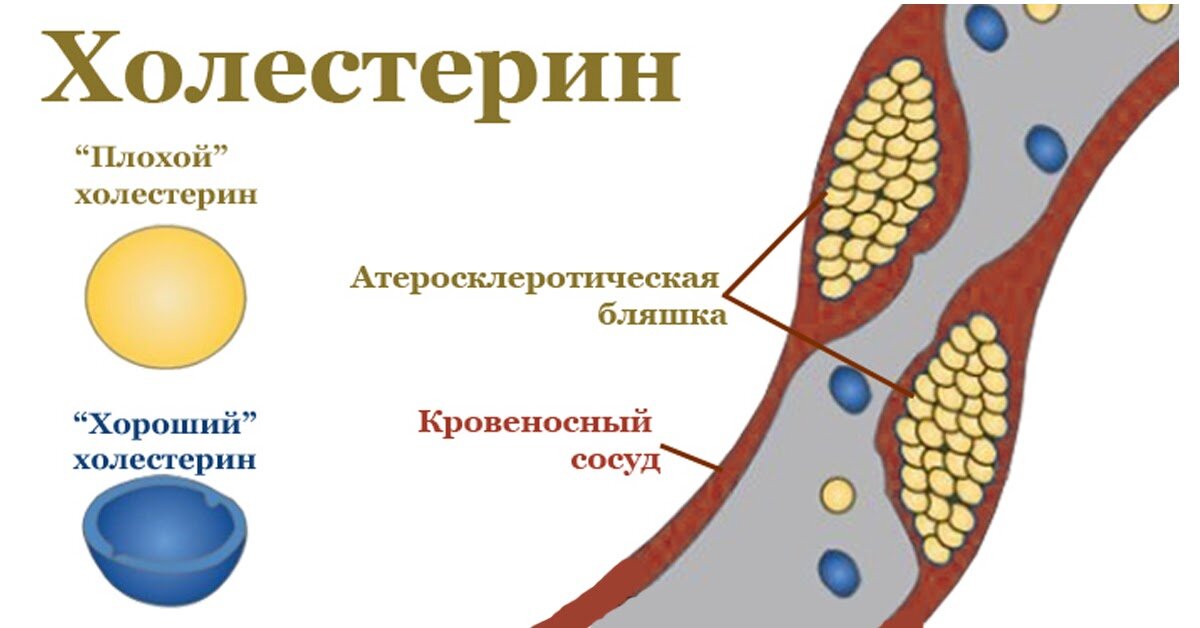 Какие продукты снижают холестерин?