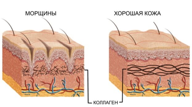 Замедление процессов обновления клеток кожи.