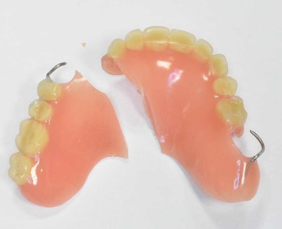 Перелом протеза. Починка линейного перелома базиса съемного пластиночного протеза. Перелом базиса бюгельного протеза. Перелом базиса съемного пластиночного протеза. Линейный перелом базиса съемного протеза..