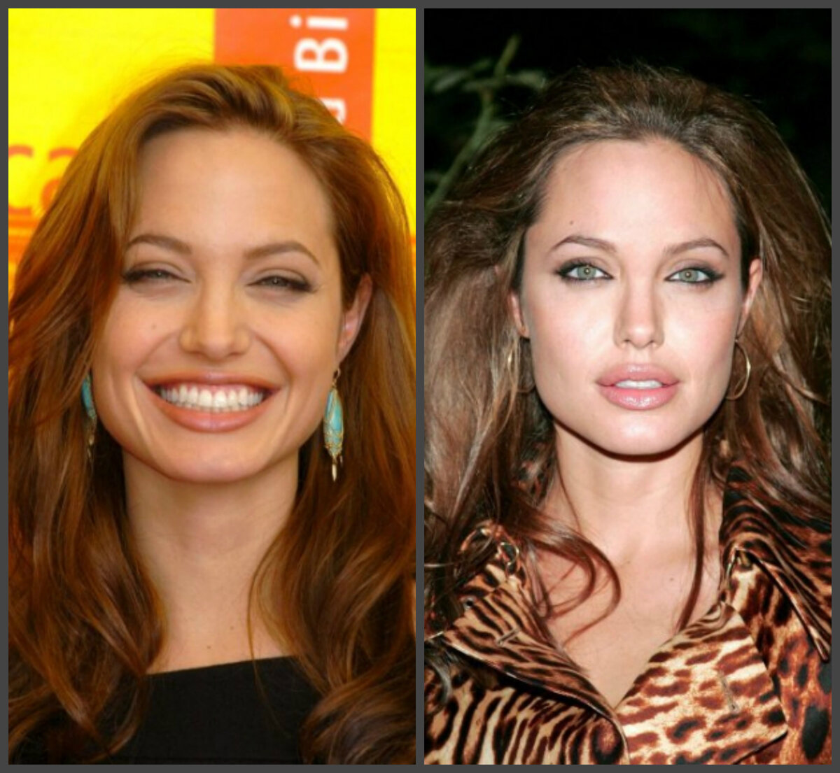 Джоли до и после пластики