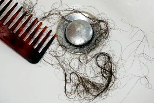 Выпадение волос при мытье и расчесывании