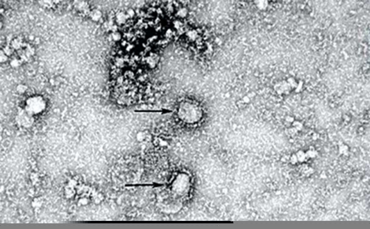 Коронавирусы под микроскопом