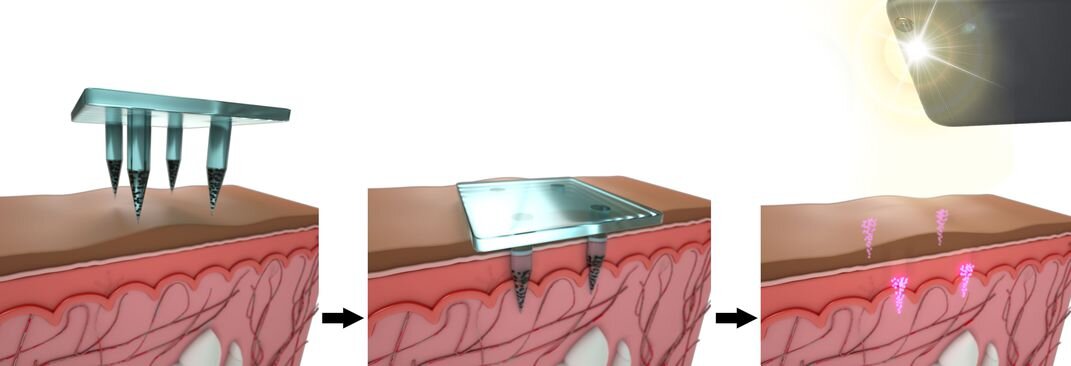 с просторов интернета