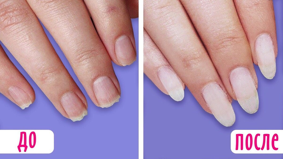 Отрастить ногти можно