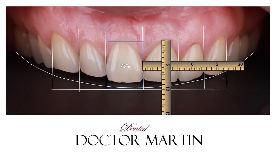 Источник https://www.instagram.com/dental_doctor_martin/
