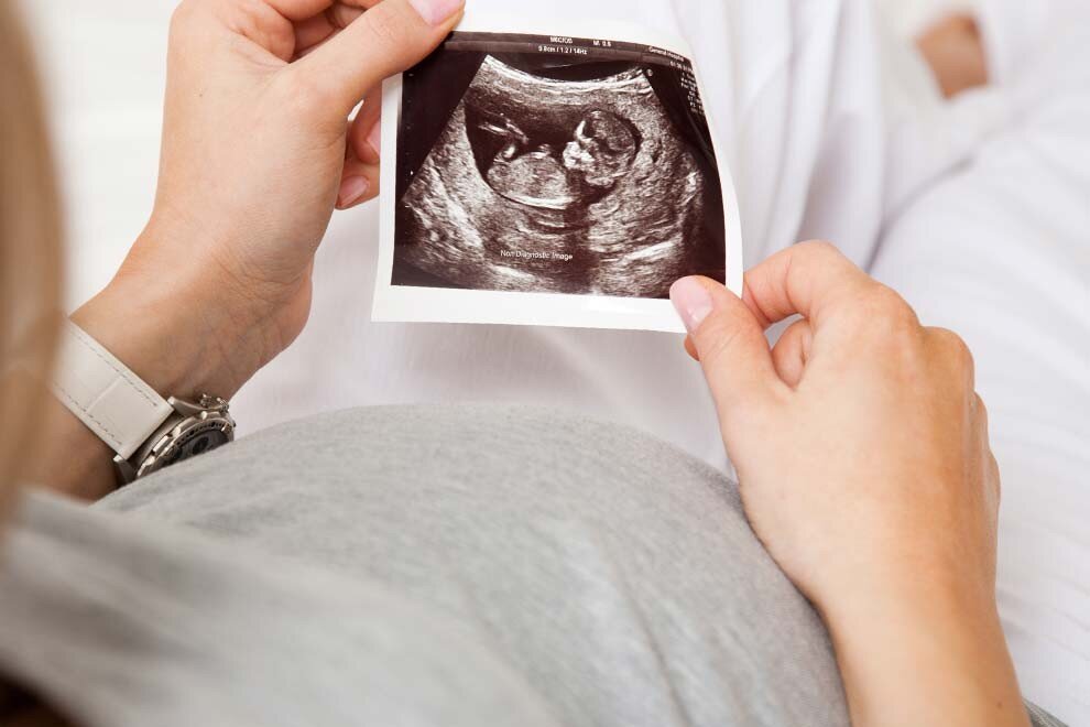 13 неделя коричневые. Снимок УЗИ. Пол ребенка на УЗИ. УЗИ беременной пол ребенка. УЗИ определение пола.