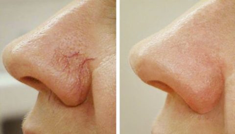  Фото: Как выглядит сосудистая сеточка