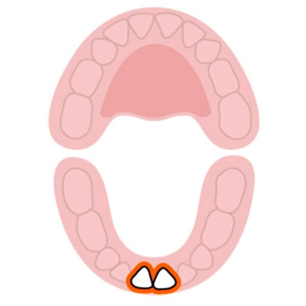Нижние центральные резцы