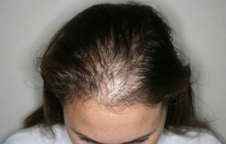 Не доводите до такого состояния, принимайте меры вовремя!