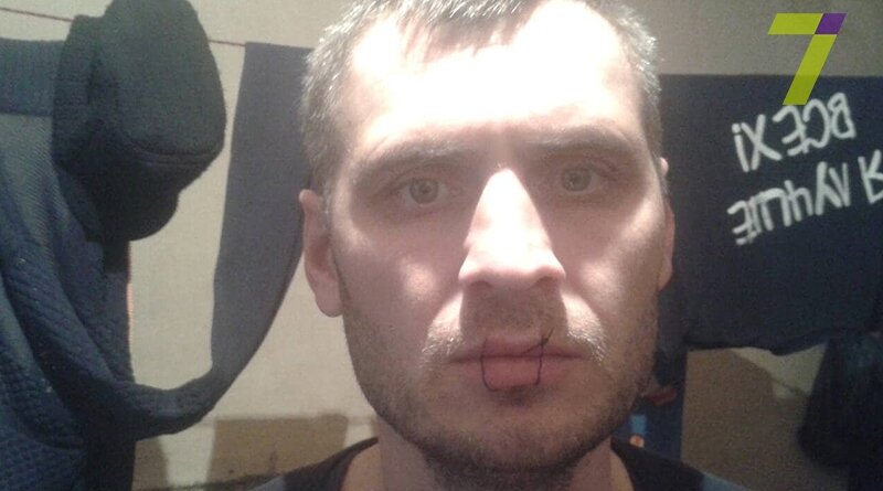  
 Один из обвеняемых в погроме сельского магазина в селе Яровое Тарутинского района который сейчас находится в сизо,отрицает свою вину и в знак протеста 3 февраля он объявил голодовку,но ему некто не поверил,после чего он зашил себе рот. Обвеняют  мужчину в том что он со своими приятелями 31 января зашли в магазин,уложили хозяев на пол,после чего разгромили все прилавки и скрылись на автомобиле BMW X5.Своевременно введенный план ,,Перехват" позволил полицейским  быстро задержать подозреваемых.