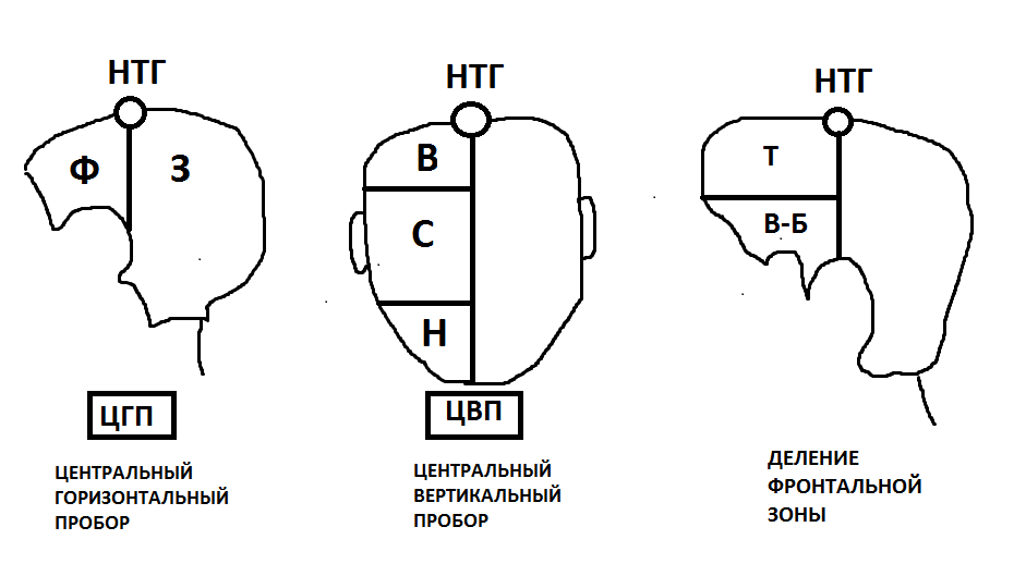 Деление головы на зоны для парикмахеров схема