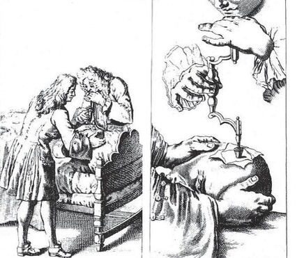 Лечение головной боли