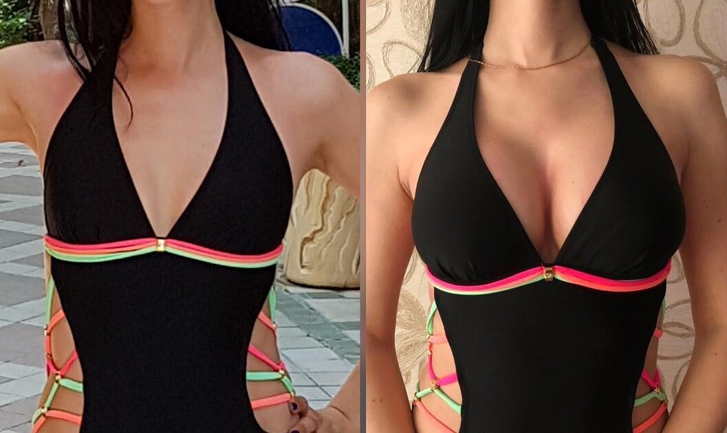 Источник:личный архив пластического хирурга Константиновой И.В.