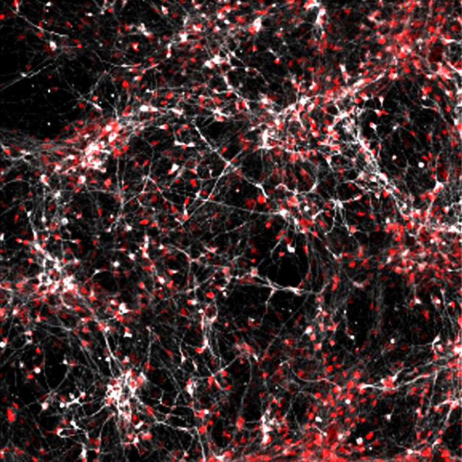    Credit: Salk Institute На этом снимке белым и красным показаны нейроны, культивированные от пациента с биполярным расстройством.