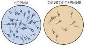 Ученые выяснили, как именно тепловой стресс повреждает сперму