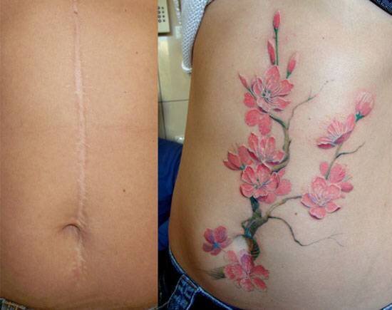 20+ людей, которые попросили тату-мастера перекрыть их шрамы - и получилось круто