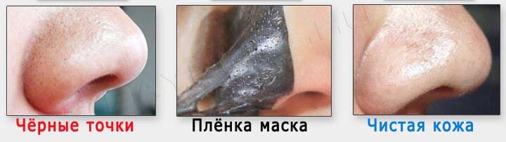 Маска-пленка от черных точек за 8 рублей: делюсь проверенным средством