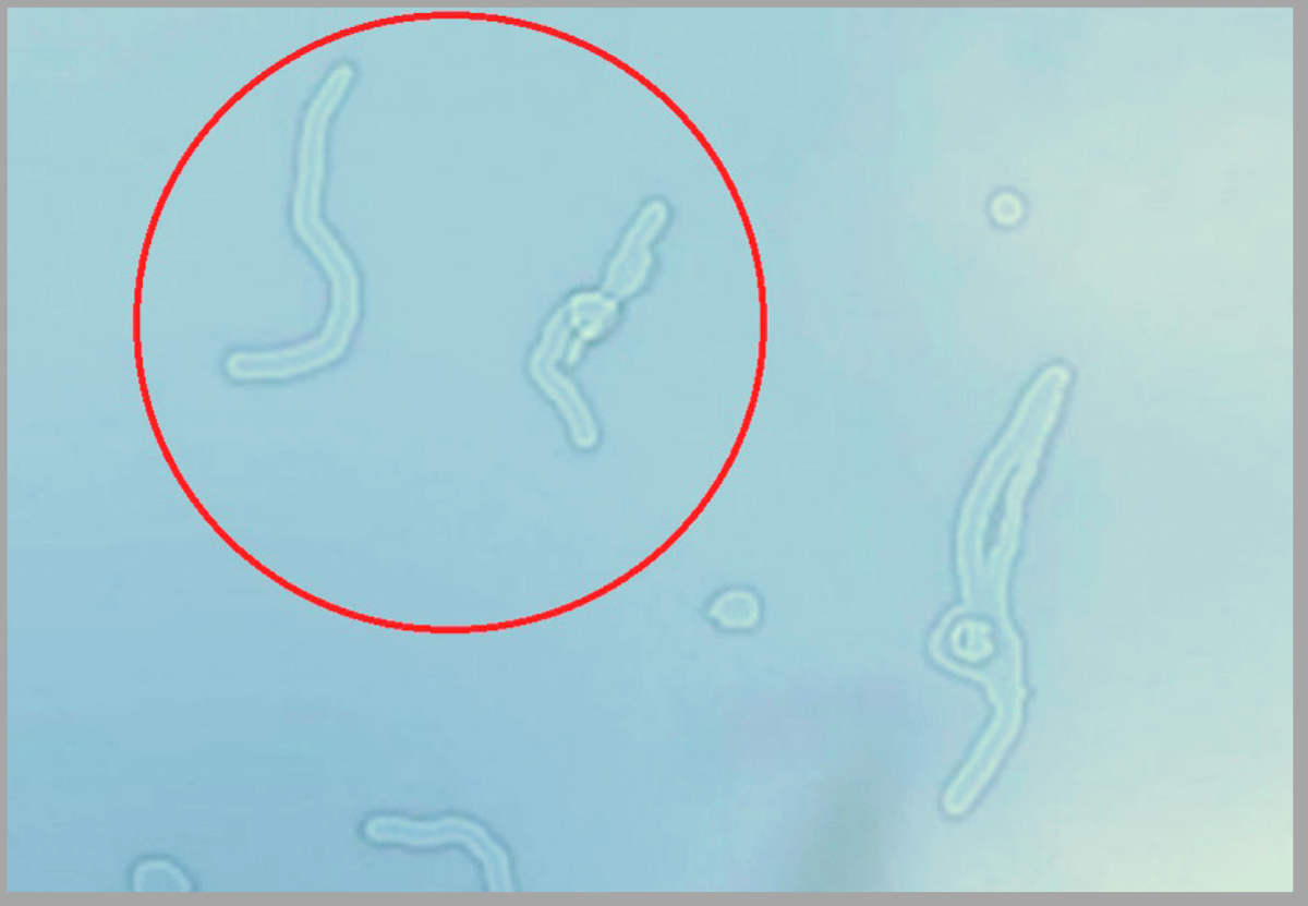 Фото "червичков" наука, 