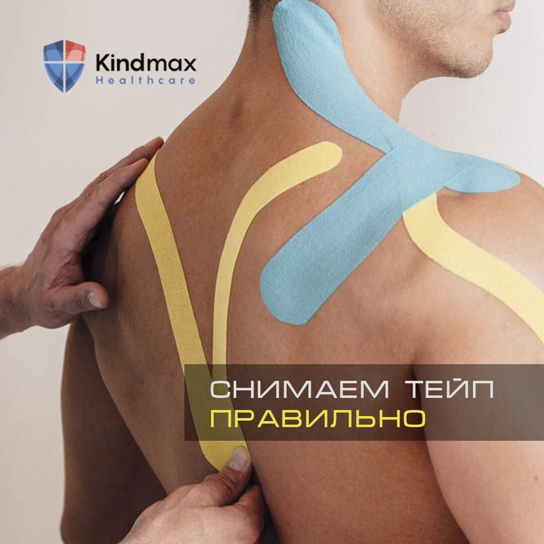 Тейпы могут быть не безобидны!